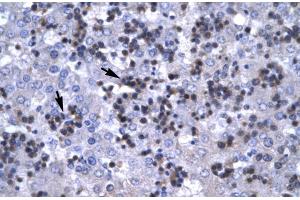 Human Liver (RBPJ Antikörper  (C-Term))