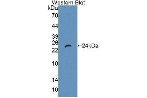 Figure. (LIG1 Antikörper  (AA 484-663))