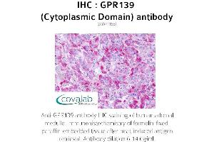 Image no. 2 for anti-G Protein-Coupled Receptor 139 (GPR139) (3rd Cytoplasmic Domain) antibody (ABIN1734944) (GPR139 Antikörper  (3rd Cytoplasmic Domain))