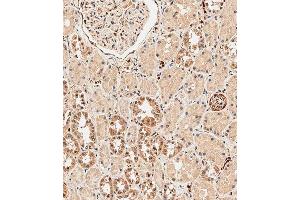 Immunohistochemical analysis of paraffin-embedded human kidney tissue using B performed on the Leica® BOND RXm. (ABCF1 Antikörper  (C-Term))