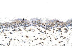 Rabbit Anti-FTCD Antibody ,Paraffin Embedded Tissue: Human Skin  Cellular Data: Squamous epithelial cells  Antibody Concentration: 4. (FTCD Antikörper  (N-Term))