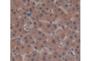 IHC-P analysis of liver tissue, with DAB staining. (ADAMTS13 Antikörper  (AA 682-859))
