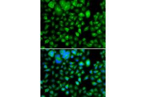 Immunofluorescence analysis of A549 cell using METTL7B antibody. (METTL7B Antikörper)