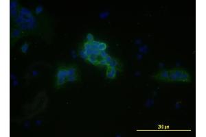 Immunofluorescence of monoclonal antibody to MCAM on JEG-3 cell . (MCAM Antikörper  (AA 24-646))