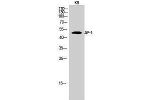 Western Blotting (WB) image for anti-Jun Proto-Oncogene (JUN) (Ser661) antibody (ABIN3173808) (C-JUN Antikörper  (Ser661))