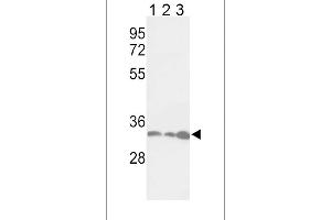 Western blot analysis of PCNA Antibody (Center) (ABIN389345 and ABIN2839454) in Jurkat(lane 1), Hela(lane 2), 293(lane 3) cell line lysates (35 μg/lane). (PCNA Antikörper  (AA 89-117))