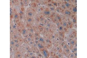 #VALUE! (Squamous Cell Carcinoma Antigen 1/2 (AA 211-390) Antikörper)