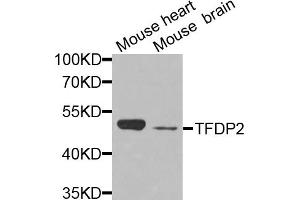 Western blot analysis of extracts of various cell lines, using TFDP2 antibody (ABIN5972290) at 1/1000 dilution. (DP2 Antikörper)