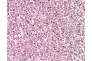 Anti-MLL2 antibody IHC of human spleen. (MLL2 Antikörper  (AA 2-14))