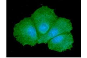 ICC/IF analysis of GALE in Hep3B cells line, stained with DAPI (Blue) for nucleus staining and monoclonal anti-human GALE antibody (1:100) with goat anti-mouse IgG-Alexa fluor 488 conjugate (Green).