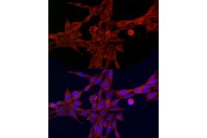 Immunofluorescence analysis of NIH/3T3 cells using SLC27 Rabbit pAb (2847) at dilution of 1:100 (40x lens). (SLC27A1 Antikörper  (AA 347-646))