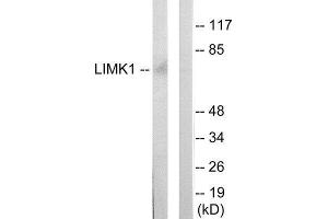 Western Blotting (WB) image for anti-LIM Domain Kinase 1 (LIMK1) (Internal Region) antibody (ABIN1849454) (LIM Domain Kinase 1 Antikörper  (Internal Region))