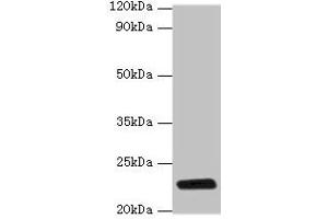 Western blot All lanes: rpiA antibody at 2 μg/mL + DH5a whole cell lysate Secondary Goat polyclonal to rabbit IgG at 1/10000 dilution Predicted band size: 23 kDa Observed band size: 23 kDa (Ribose 5-Phosphate Isomerase A (RPIA) (AA 1-219) Antikörper)