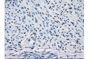 Immunohistochemical staining of paraffin-embedded endometrium tissue using anti-PPP5Cmouse monoclonal antibody. (PP5 Antikörper)