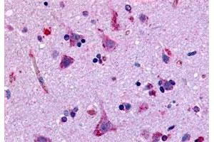 Immunohistochemistry (Formalin/PFA-fixed paraffin-embedded sections) of human brain, neurons and glia with GPR45 polyclonal antibody . (GPR45 Antikörper  (Extracellular Domain))