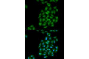 Immunofluorescence analysis of HeLa cells using PLSCR1 antibody (ABIN5974037). (PLSCR1 Antikörper)