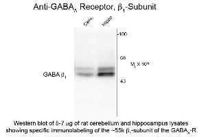 Western Blot of Anti-GABA(A) Receptor beta 1 (Rabbit) Antibody - 612-401-D49 Western Blot of Rabbit anti-GABA(A) Receptor beta 1 antibody. (GABRB1 Antikörper  (Cytoplasmic Loop))