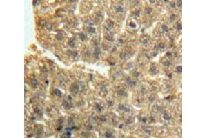 Used in DAB staining on fromalin fixed paraffin-embedded Liver tissue (GDF2 Antikörper  (AA 241-418))