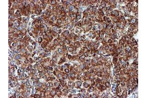 Image no. 1 for anti-NADH Dehydrogenase (Ubiquinone) 1 beta Subcomplex, 9, 22kDa (NDUFB9) (AA 3-179) antibody (ABIN1491359)