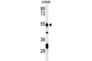 Western blot analysis of PRUNE (arrow) in Jurkat cell line lysates (35ug/lane) using PRUNE  Antibody (C-term). (PRUNE Antikörper  (C-Term))