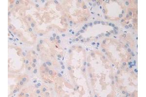 Immunohistochemistry (IHC) image for anti-Slit Homolog 1 (SLIT1) (AA 647-835) antibody (ABIN7438364)