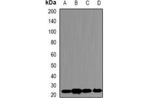 Western Blotting (WB) image for anti-Proteasome (Prosome, Macropain) Subunit, beta Type, 5 (PSMB5) antibody (ABIN7306068)
