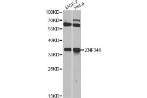 Western blot analysis of extracts of various cell lines, using ZNF346 antibody (ABIN5971759) at 1/1000 dilution. (ZNF346 Antikörper)