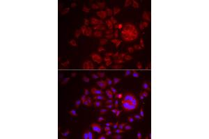 Immunofluorescence analysis of HeLa cells using SPINT1 antibody (ABIN6131743, ABIN6148359, ABIN6148360 and ABIN6222046). (SPINT1 Antikörper  (AA 234-513))