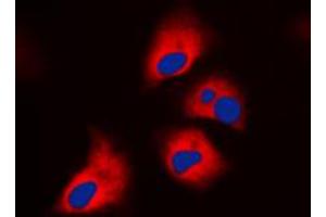 Immunofluorescent analysis of NF1 staining in HeLa cells.