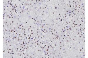 ABIN6276711 at 1/100 staining Human liver tissue by IHC-P. (NFATC1 Antikörper  (Internal Region))