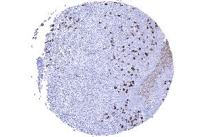 Immunohistochemistry (IHC) image for Rabbit anti-Human IgA antibody (ABIN7477497)