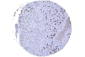 IgA positive plasma cells are numerous in the tonsil (Rekombinanter Kaninchen anti-Human IgA Antikörper)