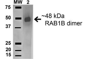 Western blot analysis of Human HeLa and 293Trap cell lysates showing detection of 22. (RAB1B Antikörper  (AA 179-189) (PerCP))