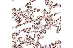 Immunohistochemistry (IHC) image for anti-Cold Inducible RNA Binding Protein (CIRBP) antibody (ABIN7266452)