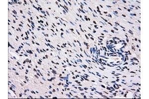 Immunohistochemical staining of paraffin-embedded colon tissue using anti-RPA2 mouse monoclonal antibody. (RPA2 Antikörper)