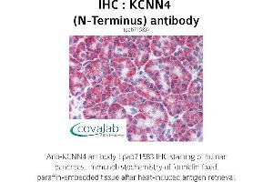 Image no. 1 for anti-Potassium Intermediate/small Conductance Calcium-Activated Channel, Subfamily N, Member 4 (KCNN4) (N-Term) antibody (ABIN1736196) (KCNN4 Antikörper  (N-Term))