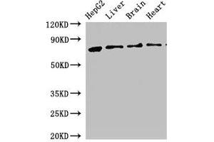 Western Blot Positive WB detected in: HepG2 whole cell lysate, Rat liver tissue, Rat brain tissue, Mouse heart tissue All lanes: KLKB1 antibody at 2. (KLKB1 Antikörper  (AA 503-612))