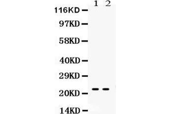 Lipocalin 2 Antikörper  (AA 21-200)