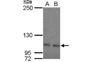 WB Image Sample (30 ug of whole cell lysate) A: 293T B: A431 5% SDS PAGE antibody diluted at 1:500 (OCRL Antikörper  (C-Term))