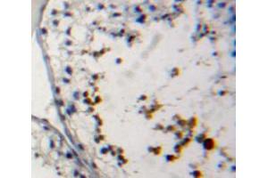 Used in DAB staining on fromalin fixed paraffin- embedded testis tissue (PRM2 Antikörper  (AA 2-100))