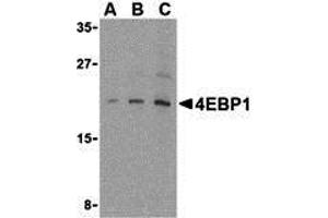 Western Blotting (WB) image for anti-Eukaryotic Translation Initiation Factor 4E Binding Protein 1 (EIF4EBP1) (C-Term) antibody (ABIN1030211) (eIF4EBP1 Antikörper  (C-Term))