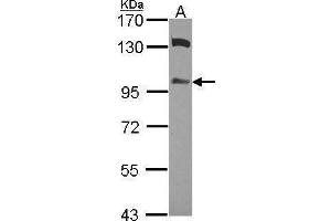 WB Image Sample (30 ug of whole cell lysate) A: A549 7. (ZAK Antikörper)