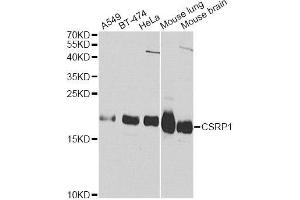 Western blot analysis of extracts of various cell lines, using CSRP1 Antibody (ABIN5970430) at 1/1000 dilution. (CSRP1 Antikörper)