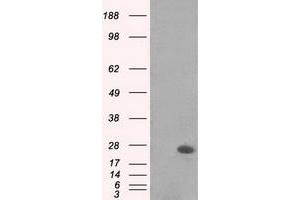 Image no. 1 for anti-MAD2 Mitotic Arrest Deficient-Like 1 (Yeast) (MAD2L1) antibody (ABIN1499249) (MAD2L1 Antikörper)