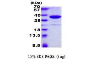 Image no. 1 for Single-Strand-Selective Monofunctional Uracil-DNA Glycosylase 1 (SMUG1) protein (His tag) (ABIN1098479) (SMUG1 Protein (His tag))
