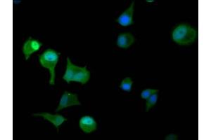 Immunofluorescence staining of MCF-7 cells with ABIN7145552 at 1:100, counter-stained with DAPI. (PAPSS2 Antikörper  (AA 2-138))