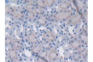 Immunohistochemistry (IHC) image for anti-Latent Transforming Growth Factor beta Binding Protein 1 (LTBP1) (AA 1415-1712) antibody (ABIN7440761)