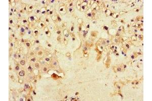 Immunohistochemistry of paraffin-embedded human placenta tissue using ABIN7150861 at dilution of 1:100 (DNAH1 Antikörper  (AA 2225-2407))
