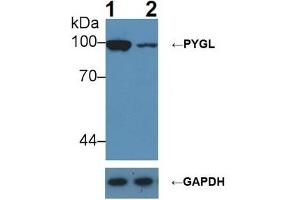 Western blot analysis of (1) Wild-type Hepg2 cell lysate, and (2) PYGL knockout Hepg2 cell lysate, using Rabbit Anti-Rat PYGL Ab (1 µg/ml) and HRP-conjugated Goat Anti-Mouse antibody ( (PYGL Antikörper  (AA 341-509))