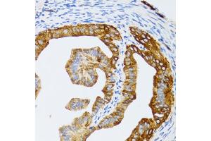 Immunohistochemistry of paraffin-embedded rat fallopian tube using CHAF1B antibody (ABIN5973690) at dilution of 1/100 (40x lens).